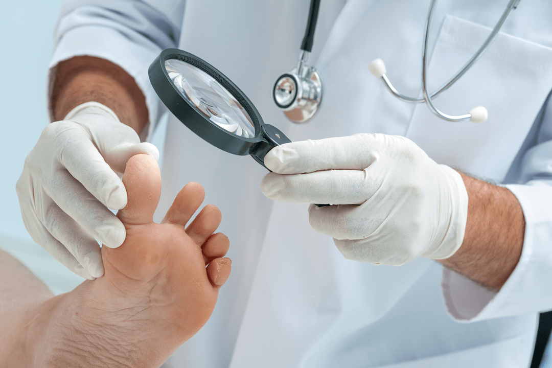 diagnosis of nail fungus