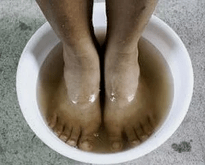 Rules for the treatment of nail fungus