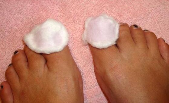 compress for the treatment of toenail fungus