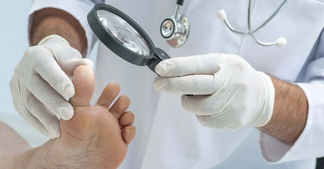 The doctor will prescribe medicine for toenail fungus after diagnosing the disease