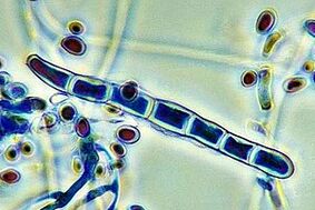 nail fungus pathogen under the microscope